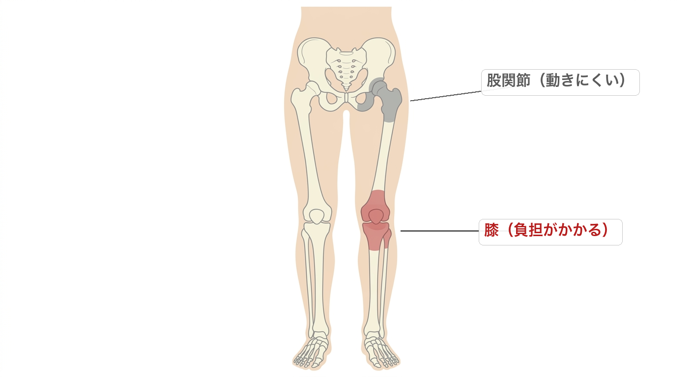 股関節が硬いと膝に負担がかかることを示した下半身の図