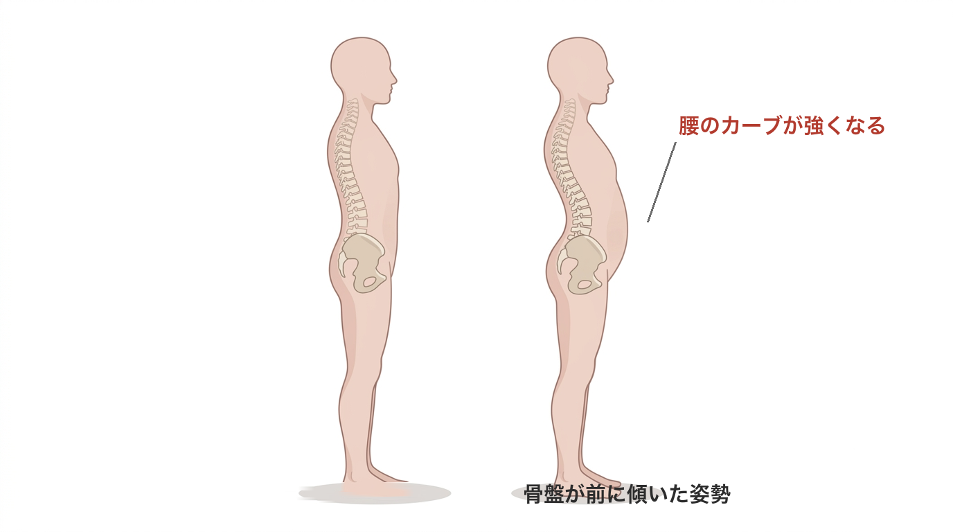 骨盤が前に傾くと腰のカーブが強くなることを、横から比べたイラスト