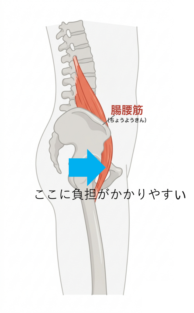 腰椎から股関節の前を通り太ももの内側につく腸腰筋の解剖図。股関節の前側に負担がかかりやすいことを示す