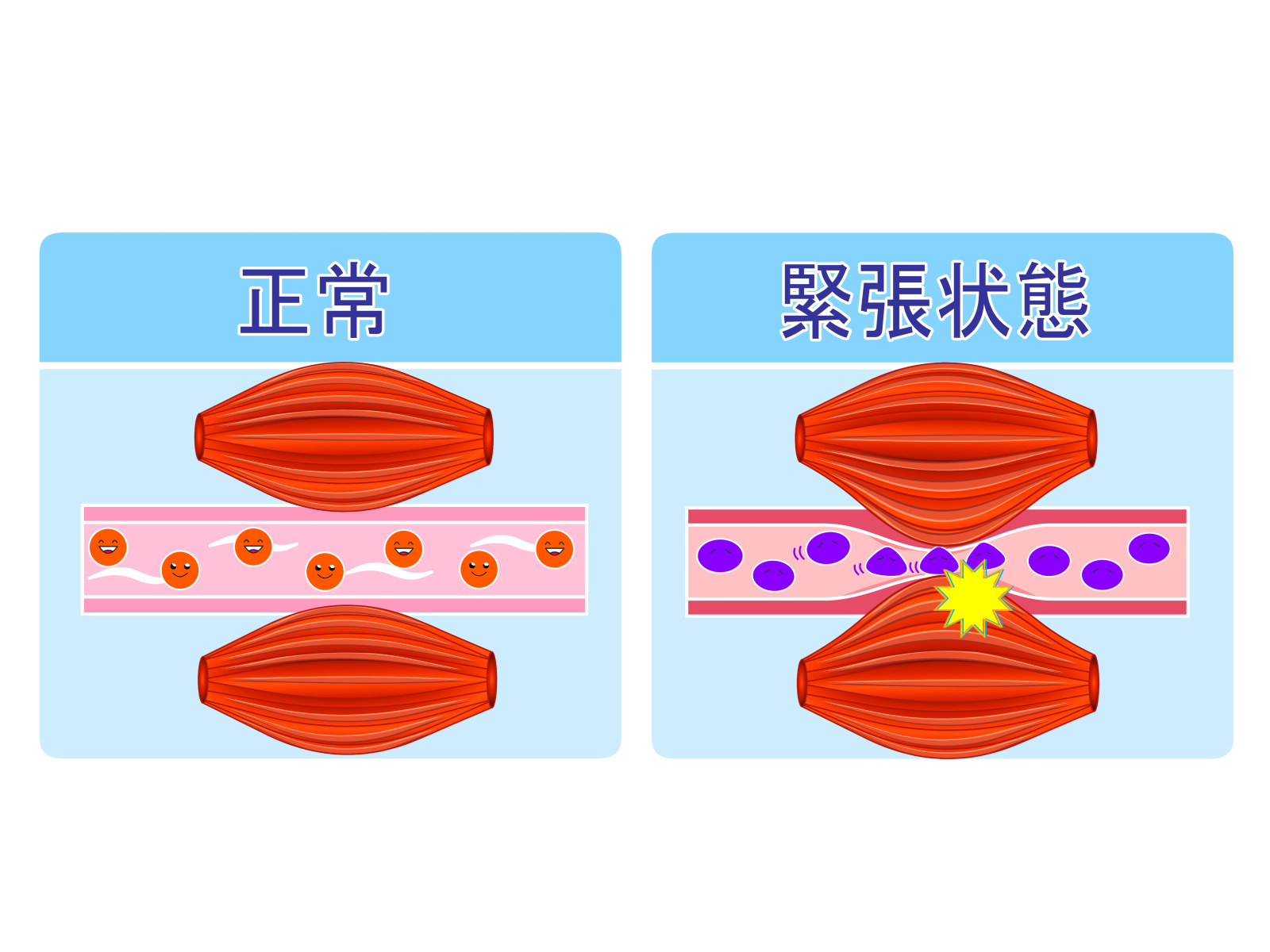 筋肉が緊張すると血管が細くなり血流が滞る比較図