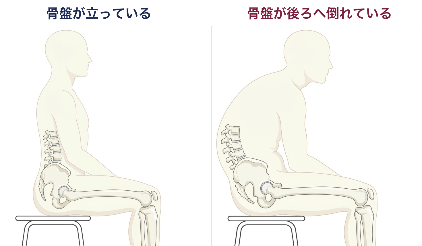 骨盤が立っている座り方と、骨盤が後ろへ倒れている座り方の比較